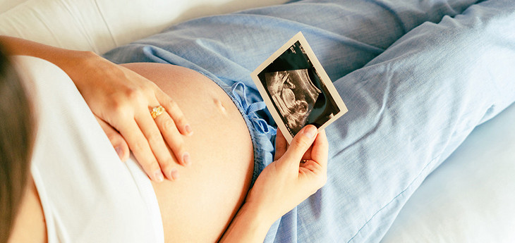 eine schwangere Frau liegt auf einem Sofa und hält ein Ultraschall-Bild